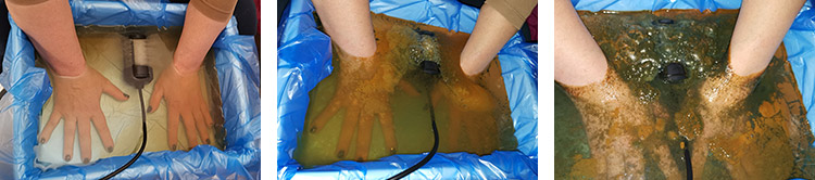Detox terapija